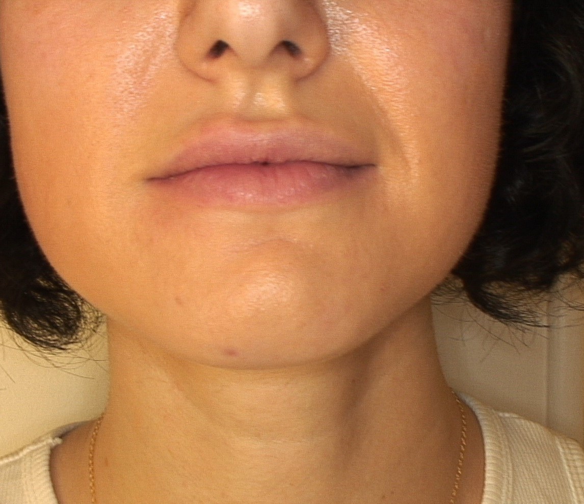 After